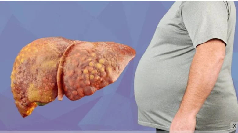 ছবির ক্যাপশন: ছবি সংগ্রহীত